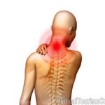 علائم و راههای درمان دیسک گردن