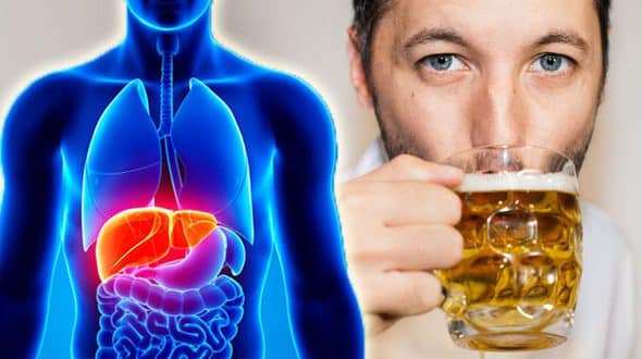 افزایش بیماری‌های کبدی در انگلستان در اثر مصرف مشروبات الکلی