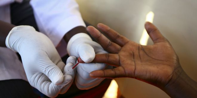 راههای جدید برای درمان ايدز