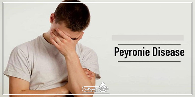 بیماری پیرونی (Peyronies) سبب ناتوانی جنسی می شود