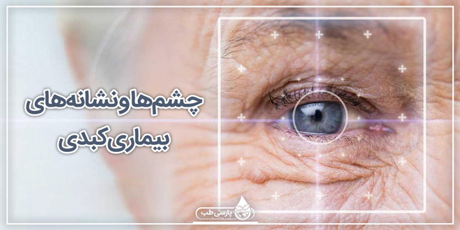 چشم‌ها و نشانه‌های بیماری کبدی