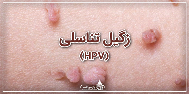 زگیل تناسلی (HPV)