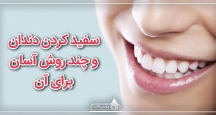سفید کردن دندان و چند روش آسان برای آن