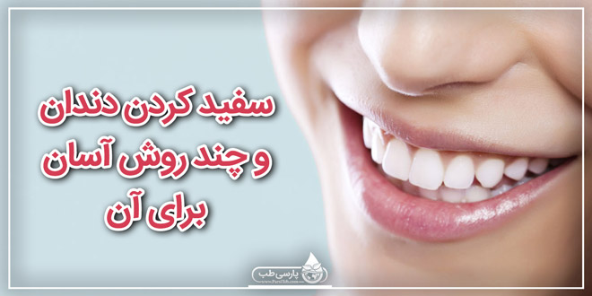 سفید کردن دندان و چند روش آسان برای آن