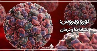 نورو ویروس: نشانه‌ها و درمان
