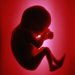 عفونت ادراری در زنان باردار باعث سقط جنین می‌شود .