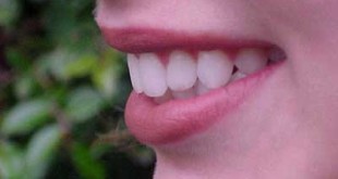 راههی سفید کردن دندان