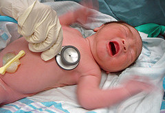 سزارين خطر ابتلا به بيماريهاي تنفسي را در نوزاد افزايش مي دهد.