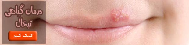 lip-herpes