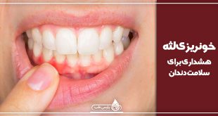 خونریزی لثه ، هشداری برای سلامت دندان