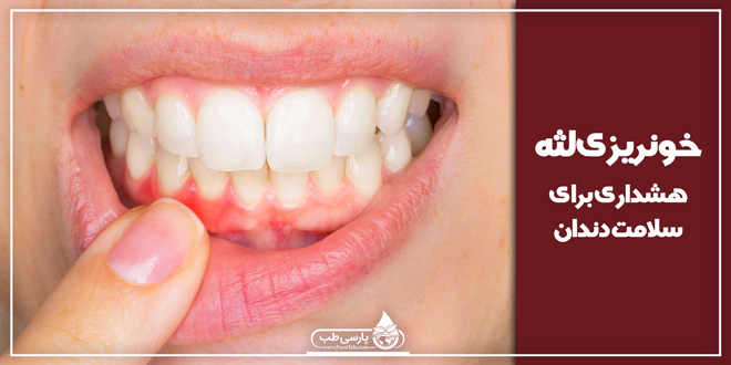 خونریزی لثه ، هشداری برای سلامت دندان
