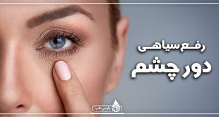 روش درمان سیاهی دور چشم