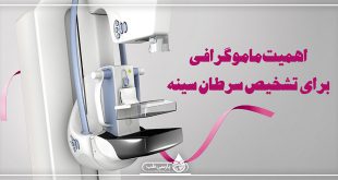 اهمیت ماموگرافی برای تشخیص سرطان سینه