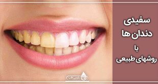 سفیدی دندان ها با روشهای طبیعی
