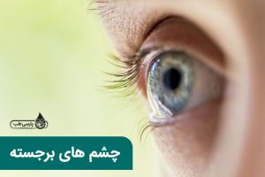 تشخیص بیماری از روی چشم