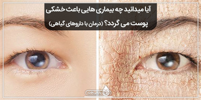 آیا میدانید چه بیماری هایی باعث خشکی پوست می گردد؟ (درمان با داروهای گیاهی)