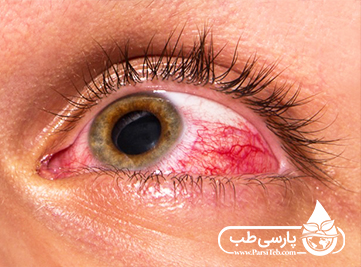 اثرات مضر مواد شوینده برای چشم