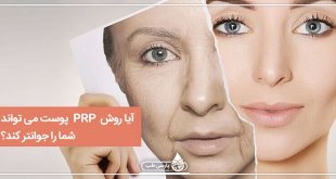 آیا روش [PRP] پوست می تواند شما را جوانتر کند؟
