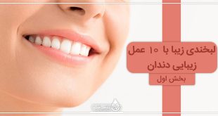 لبخندی زیبا با 10 روش زیبایی دندان (I)