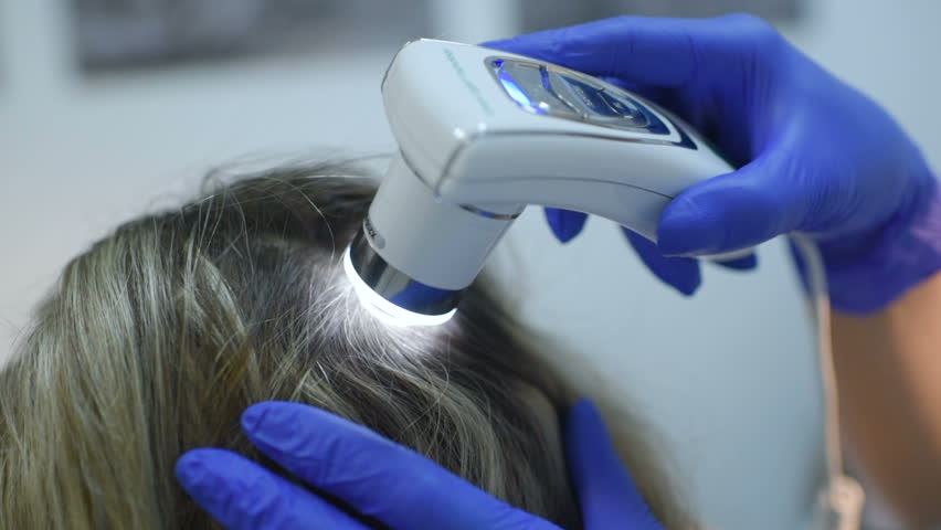 دستگاه سنجش مو یا Trichoscopy