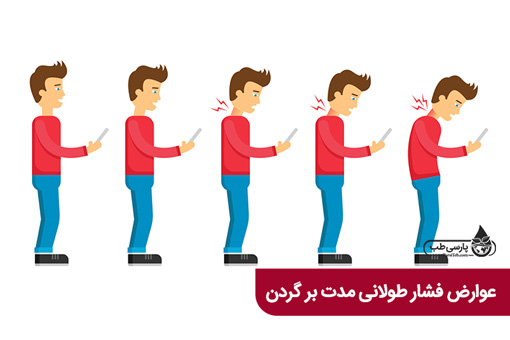 سندروم تکست نک
