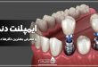 ایمپلنت دندان و معرفی بهترین دکترها در مشهد