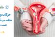 حرکات ورزشی مناسب PCOS (قسمت اول)