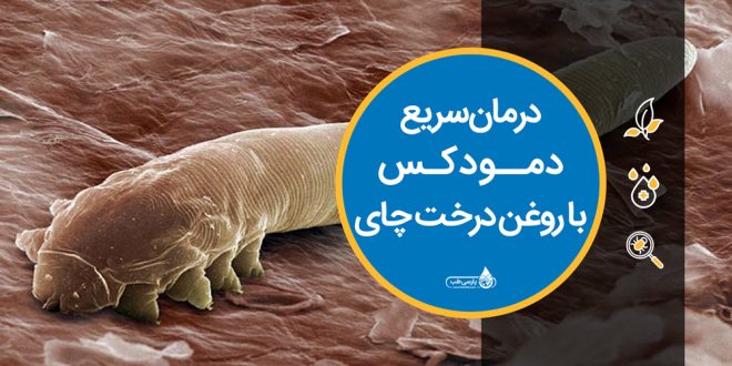 درمان سریع دمودکس با روغن درخت چای